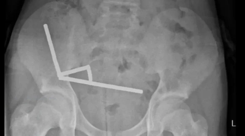 Українські Національні Новини (УНН)